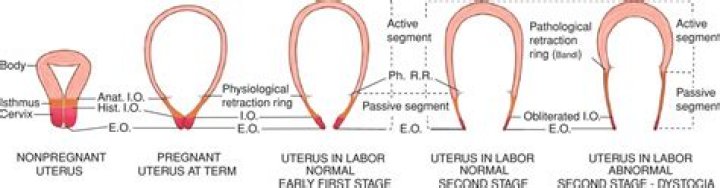 What is normal uterine resting tone